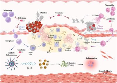 Role of inflammation and evidence for the use of colchicine in patients with acute coronary syndrome